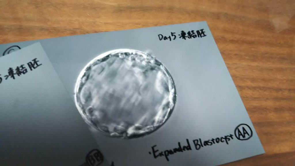 採卵した凍結胚の写真