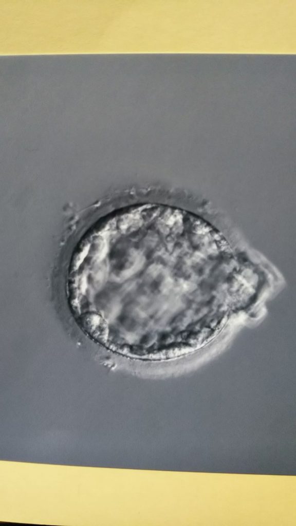 解けた胚盤胞の写真の画像